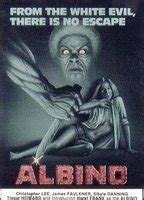 Albino Nude Scenes Aznude