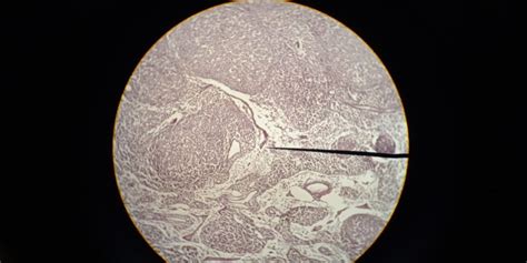 Reticular Tissue (Dense Proper CT) – Anatomy