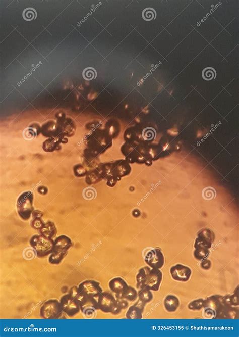 Starch Granules Viewed Under Light Microscope Stock Image Image Of