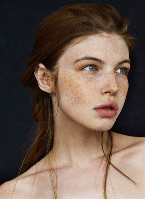 A Woman With Freckles On Her Face And Shoulder