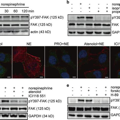 Structure Of Full Length Focal Adhesion Kinase Obtained By Hybrid