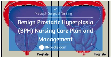 Benign Prostatic Hypertrophy Nursing Care Plan Management