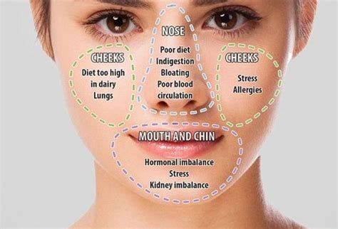 Natural Makeup Face Map In 2024 Face Mapping Health Health And