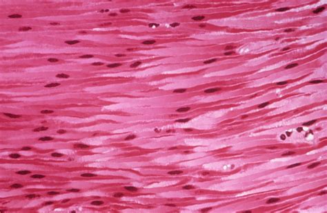 Types Of Muscle Cell Images Human Body Lessons Dk Find Out
