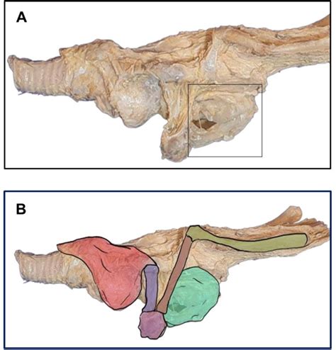 Demonstration of an anatomical structure (A) in detail and (B) green ...