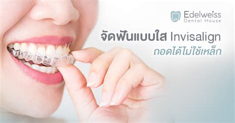 จัดฟันแบบใส Invisalign ถอดได้ไม่ใช้เหล็ก