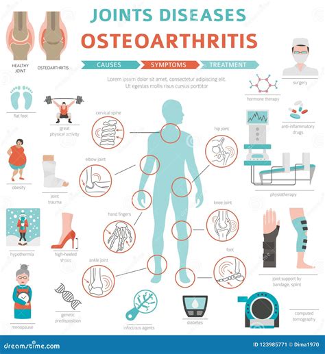 Joints Diseases. Arthritis, Osteoarthritis Symptoms, Treatment I Stock