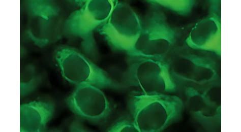 Me1 Malic Enzyme 1 Monoclonal Antibody Irm025 Ireal