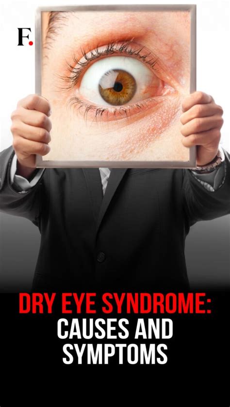 Dry eye syndrome: Causes and symptoms