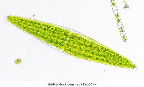 Freshwater Phytoplankton Under Microscope Species Probably Stock Photo ...