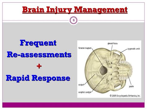 Ppt Traumatic Brain Injury Tbi Powerpoint Presentation Free