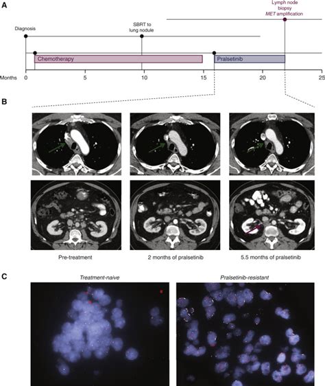 Mechanisms Of Resistance To Selective Ret Tyrosine Kinase Inhibitors In