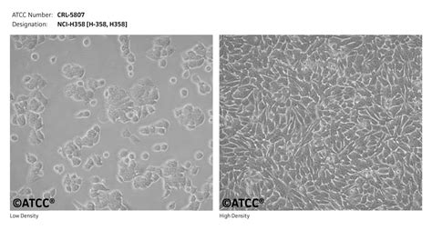 NCI H358细胞ATCC CRL 5807细胞 H358人非小细胞肺癌细胞株购买价格培养基培养条件细胞图片特征等基本信息 生物风