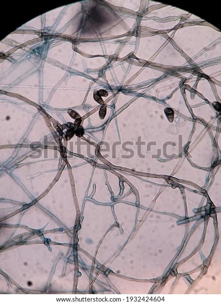 Curvularia Species On Microscopic Lpcb Stock Photo 1932424604 ...