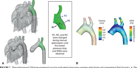 Figure 2 From Patient Specific Tissue Engineered Vascular Graft For