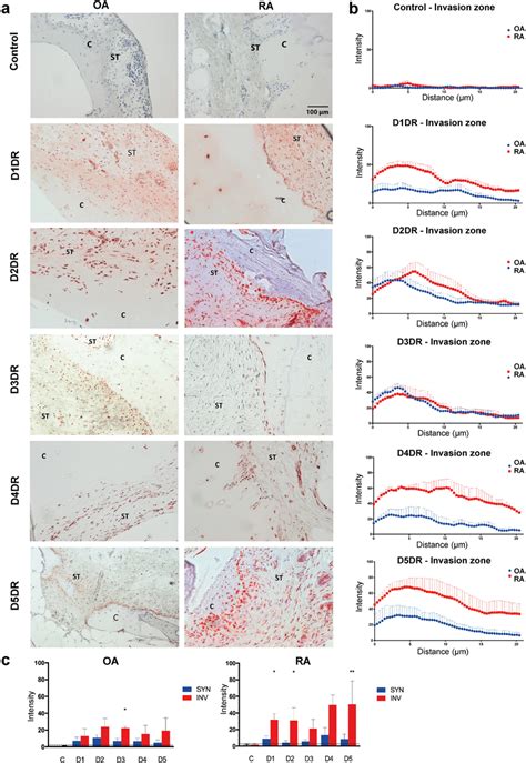 Immunohistochemical Analysis Of Dr Expression In Oa And Ra