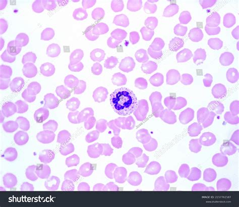 Human Blood Smear Showing Neutrophil Ringshaped Stock Photo 2157761587