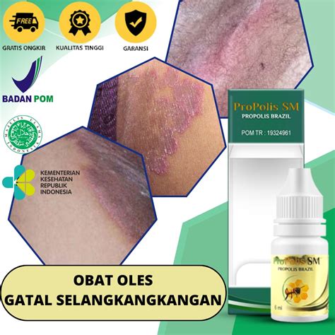 Jual Obat Gatal Selangkangan Pemutih Selangkangan Hitam Kurap Di