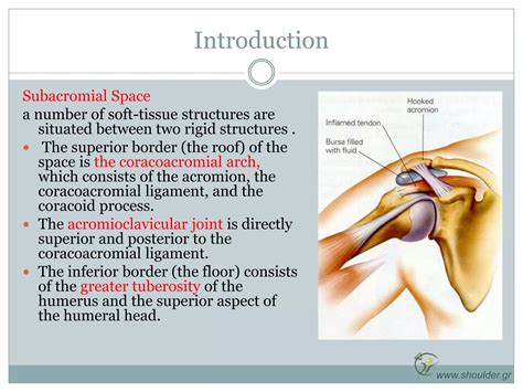 impingement syndromes pptx