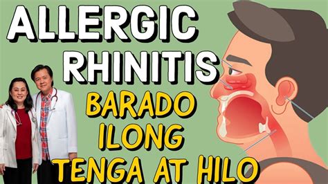 Allergic Rhinitis Barado Ilong Tenga At Hilo Payo Ni Doc Willie Ong