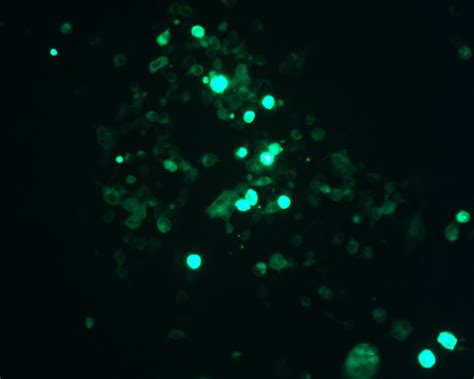 Human Epcr PROCR Gene ORF CDNA Clone Expression Plasmid C His Tag