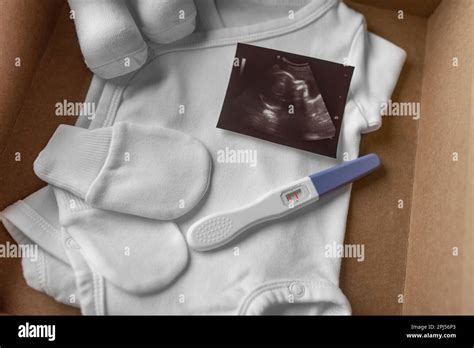 Box With Baby Stuff And Pregnancy Test Stock Photo Alamy