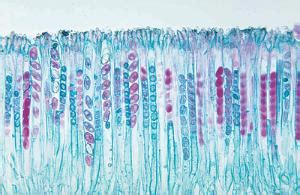 Peziza Under Microscope Labeled