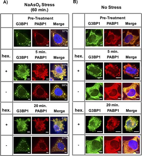 Figures And Data In Distinct Stages In Stress Granule Assembly And