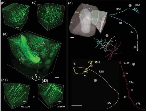 Subvoxel light-sheet microscopy for high-resolution high-throughput volumetric imaging of large ...