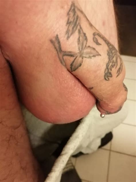 Saline Infusion In Scrotum Second Liter Nude Pics Xhamster