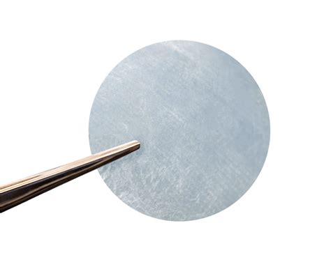 Amniotic Membrane Disc Therapy