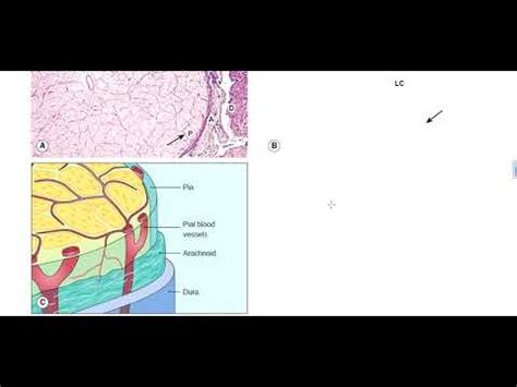 Kanski Clinical Ophthalmology made easy - neuro ophthalmology 3 - YouTube