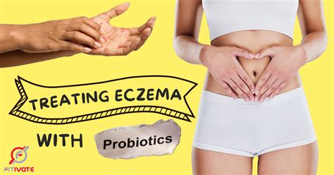 Treating Eczema with probiotics