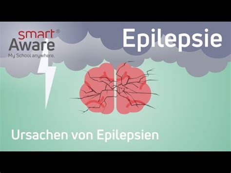 Epilepsie Ursachen Von Epilepsien Fachfortbildungen Pflege