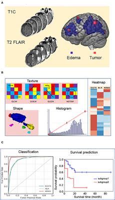 Frontiers Predicting Survival Duration With Mri Radiomics Of Brain