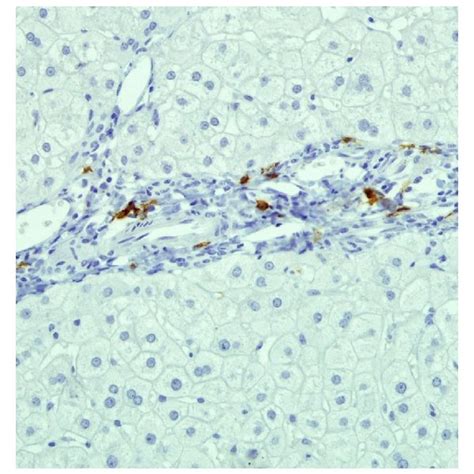 Representative Microphotographs Of CD20 Marker By Immunohistochemistry