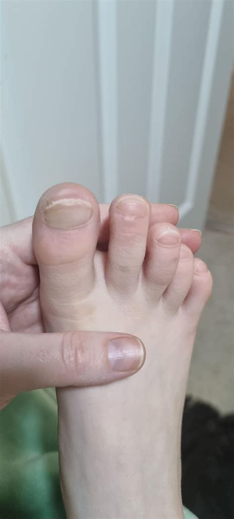 club toes images