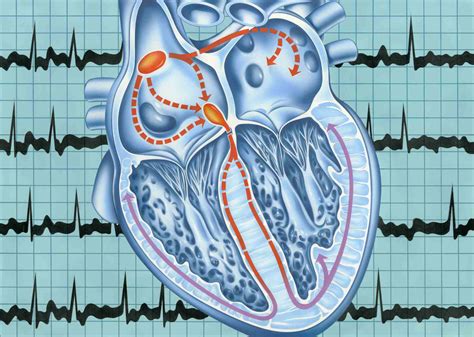 Cox Maze Procedure Uses Side Effects Procedure Results