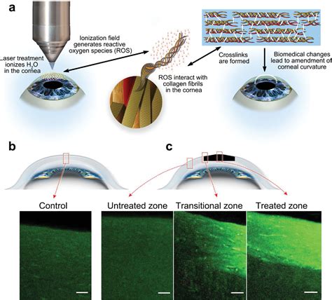 Ocular Nanomedicine Tang 2022 Advanced Science Wiley Online Library