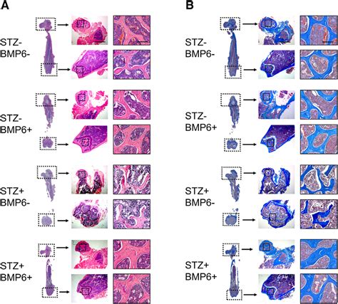 Histological Analysis Of Mouse Femurs Trabecular Bone In The