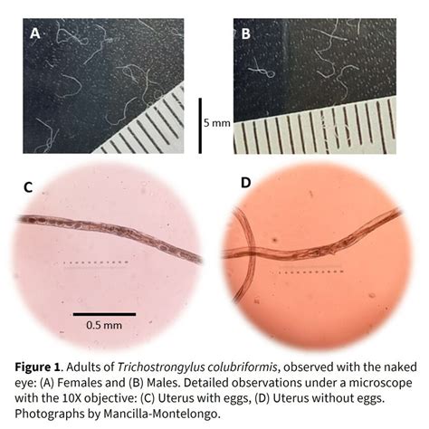 Adults Of Trichostrongylus Colubriformis Observed With The Naked Eye