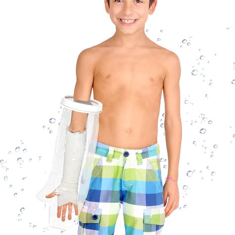 cast arm cover 1