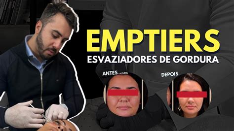 Emptiers Antes E Depois - EMPTIERS EMAGRECIMENTO FACIAL | Entenda como funciona ...