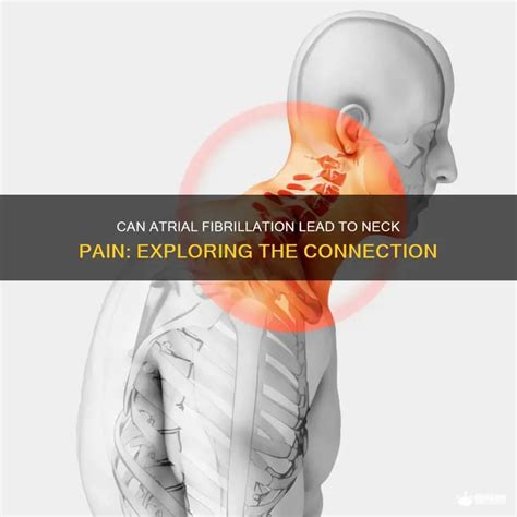 atrial fibrillation lead  neck pain exploring  connection