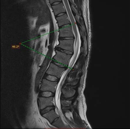 Image Radiopaedia Org