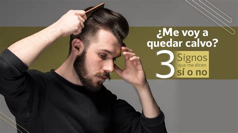 Me Voy A Quedar Calvo Signos Que Me Dicen S O No Y Una Mala Y Otra