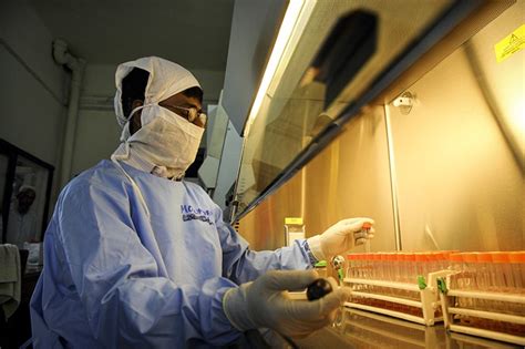 bacterial vaginosis bv  symptoms  treatment