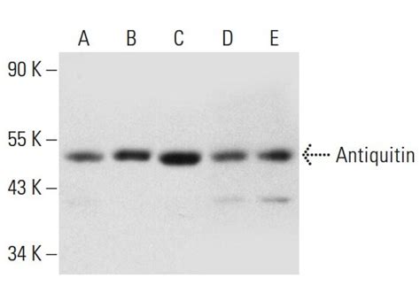 Anti Antiquitin Antibody A 7 Scbt Santa Cruz Biotechnology