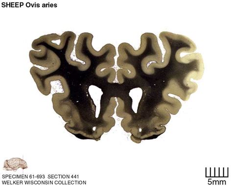 Atlas of the Sheep Brain > Section Image