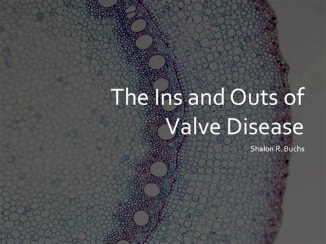 PDF The Ins And Outs Of Valve Disease Skinbonescme